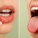 Wie erkennt man, dass es Ihnen an Folsäure mangelt